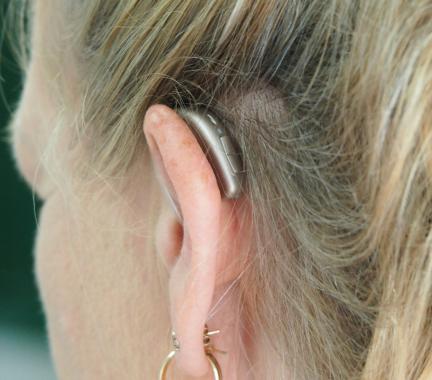 A blonde woman with a hearing aid in her ear. 