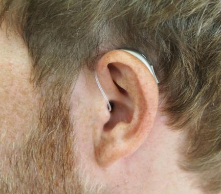 A zoomed in picture of a mans ear wearing a hearing aid. 