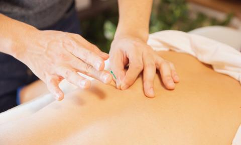 Hands placing acupuncture needle on a back