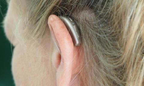 A blonde woman with a hearing aid in her ear. 