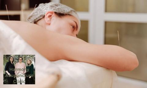 lady on stomach with acupuncture needles in arm and back with Harmony Acupuncture Clinic logo in bottom left corner