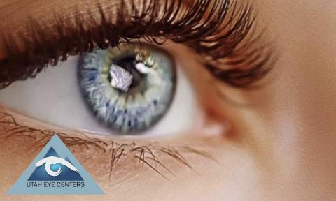 Up close image of an eyeball with Utah Eye Center logo in bottom left corner