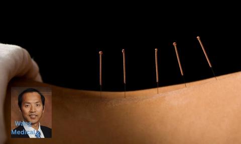 back with accupuncture needles along spine, photo of Feng-Ling Wang in bottom left corner