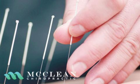 Hand with acupuncture needles with McClean Chiropractic Logo in bottom left corner