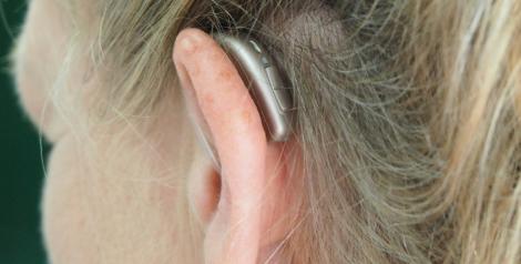 A blonde woman with a hearing aid in her ear. 