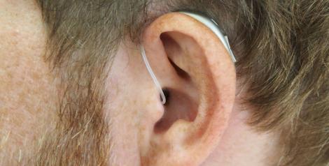 A zoomed in picture of a mans ear wearing a hearing aid. 
