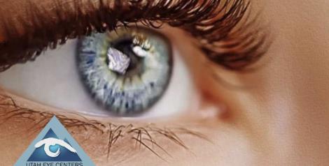 Up close image of an eyeball with Utah Eye Center logo in bottom left corner