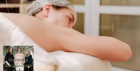 woman on stomach with acupuncture needles on arm and back, photo of 3 women with Harmony Acupuncture Clinic words overlaid in bottom left corner