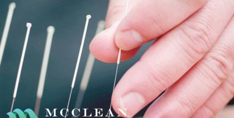 Hand with acupuncture needles with McClean Chiropractic Logo in bottom left corner