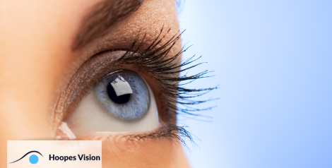 zoom in view of an eye with Hoopes Vision logo in bottom left corner