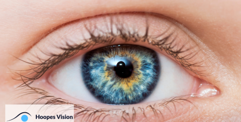 image of an eye with hoopes vision logo in bottom left corner