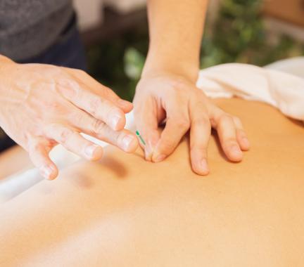 Hands placing acupuncture needle on a back